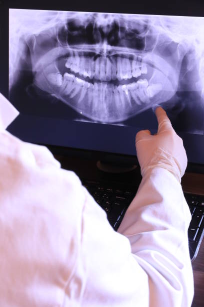 Best Emergency Dental Care for Sports Injuries in Carrizo Springs, TX