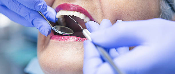 Best Emergency Dental Care for Sports Injuries in Carrizo Springs, TX